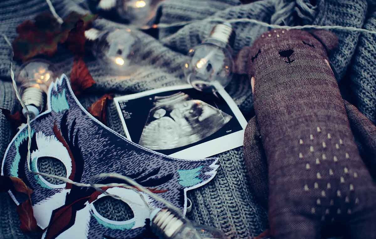 ultrasound photo surrounded by string lights.